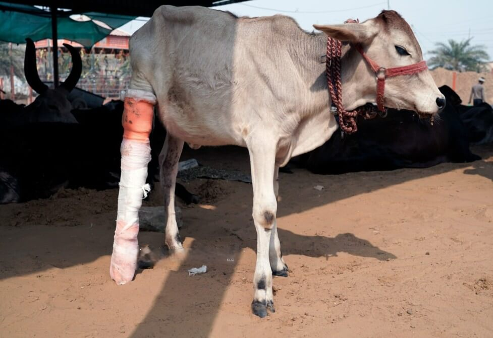 Fracture & Cesarean operation